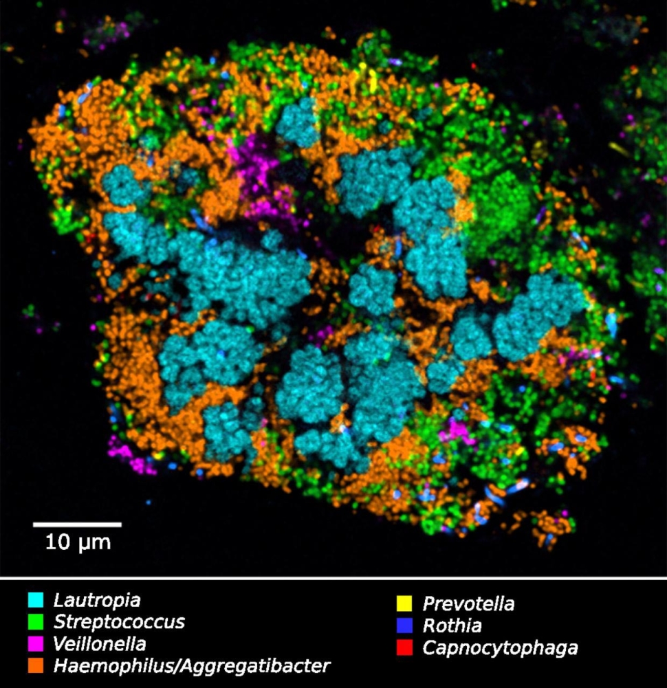Colorful image of a cauliflower-shaped mass of bacterial species