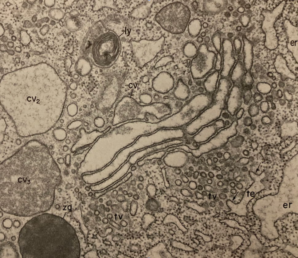 golgi electron micrograph