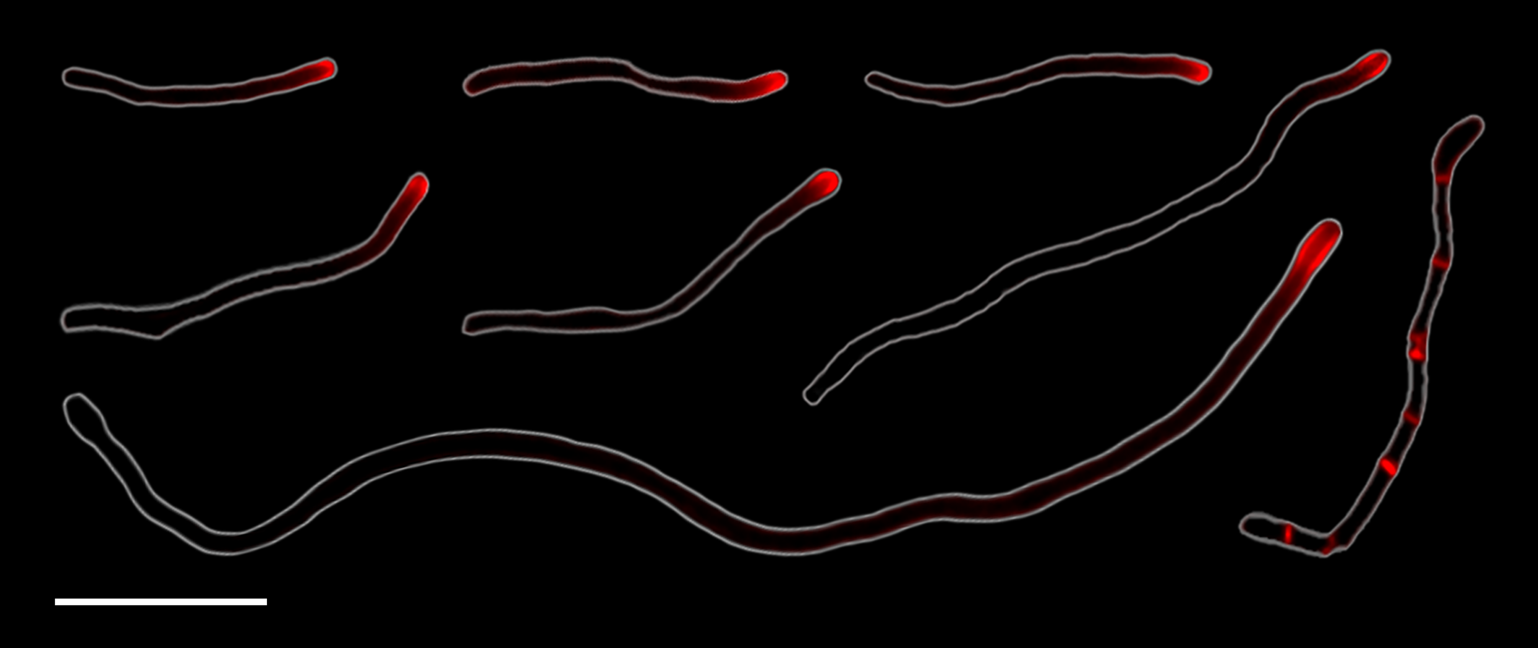 Cellular elongation at the tips of the filamentous bacteria Corynebacterium matruchotii. Credit: Chimileski et al (2024).