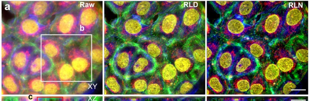 Images-of-human-cancer-cells-processed-with-Richardson-Lucy-Deconvolution---a-panel----and-a-neural-network-that-uses-RLD-Credit-Li-et-al-Nature-Methods-2022