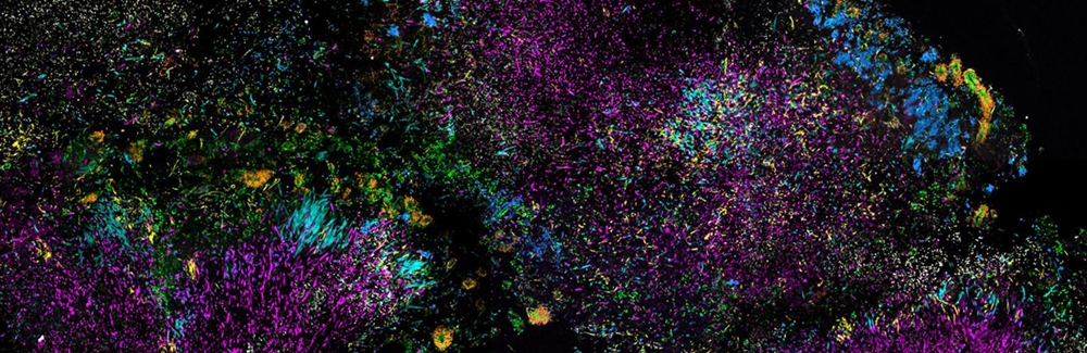 This image from the Mark Welch laboratory shows structured consortia of microbes in dental plaque.