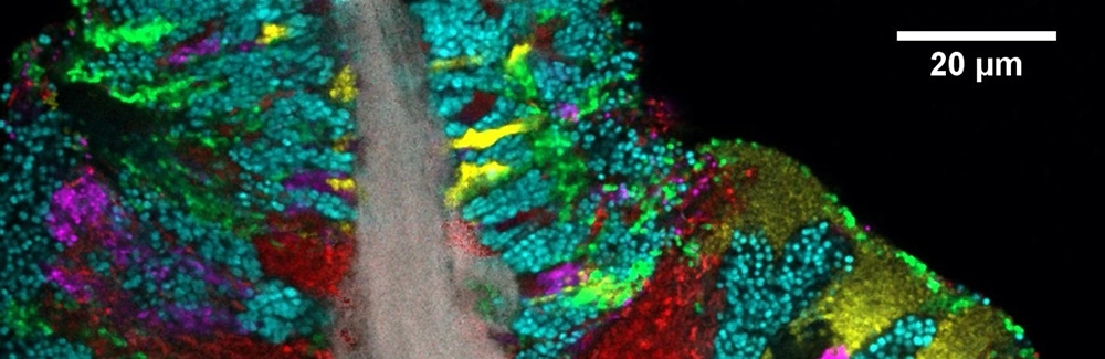 Bacterial biofilm scraped from the surface of the tongue and imaged using CLASI-FISH. Credit: Steven Wilbert and Gary Borisy, The Forsyth Institute