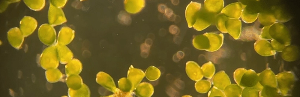 Stentor pyriformis with photosynthetic algae