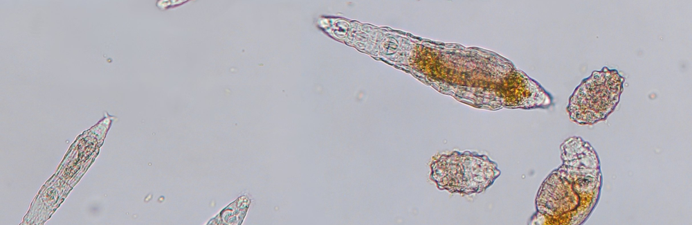 Bdelloid rotifers on a gray background. These rotifers are about a hair's breadth in size. They lay large oval eggs that will hatch into genetic copies of their mother, without needing sex or fertilisation. 