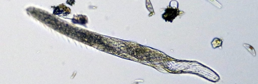 Ciliate Spirostomum ambiguum