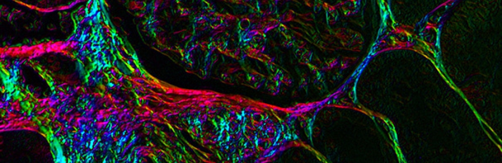 Glomerular capillaries in kidney tissue imaged with the polychromatic polarization microscope developed at MBL