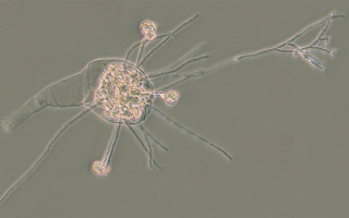 bdelloid rotifer infected by fungus