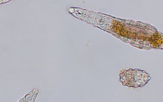 Bdelloid rotifers on a gray background. These rotifers are about a hair's breadth in size. They lay large oval eggs that will hatch into genetic copies of their mother, without needing sex or fertilisation. 