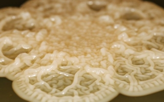  A colony of the dental plaque bacterium Corynebacterium matruchotii. (Scott Chimileski/Marine Biological Laboratory) 