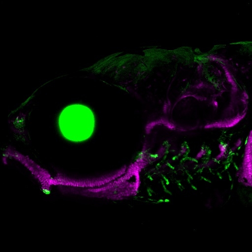 Zebrafish microscopy image Credit Mathi Thiruppathy/Crump Lab