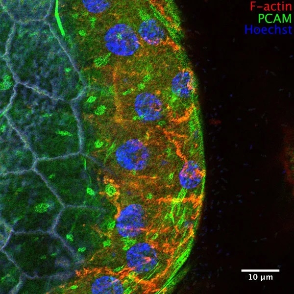 A student-generated image after learning super-resolution techniques in AQLM 2018. Credit: Mary Ann Collins